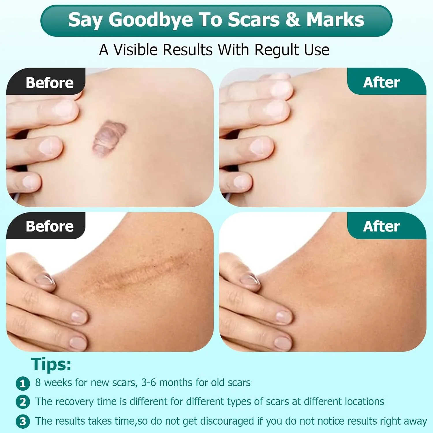 Advanced Scar Gel
