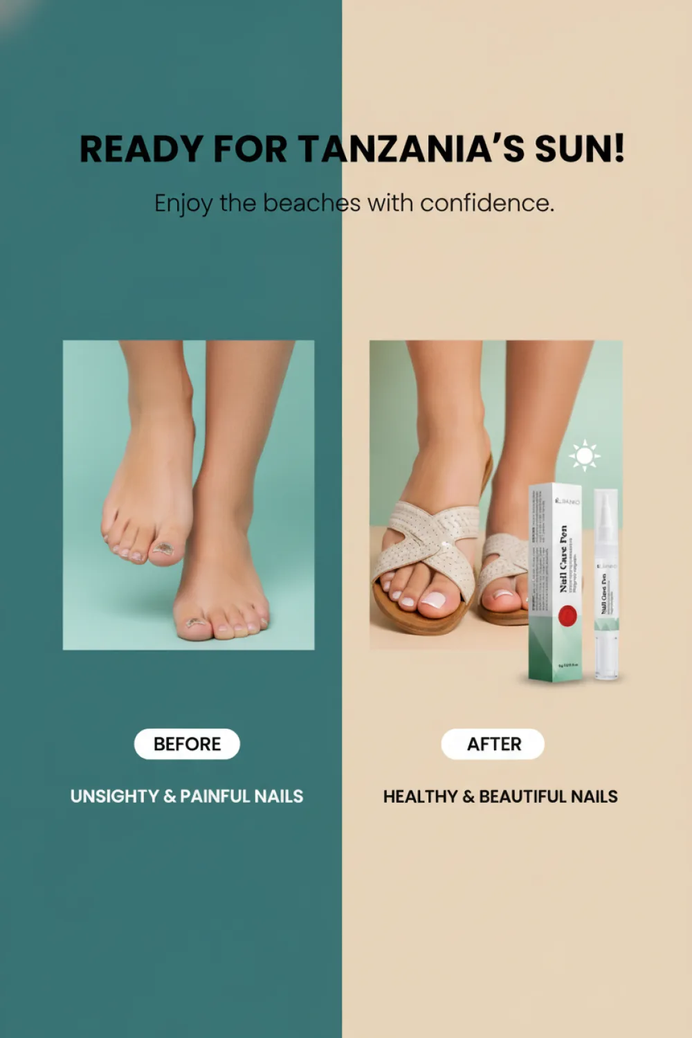 Before / After